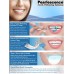 Pearlescence Teeth Whitening System Photo-Initiated Gel Kit 35% Mint